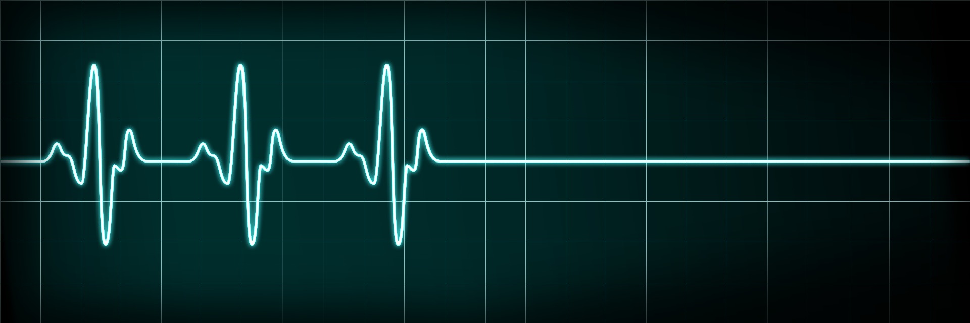Heart monitor showing when a person has died
